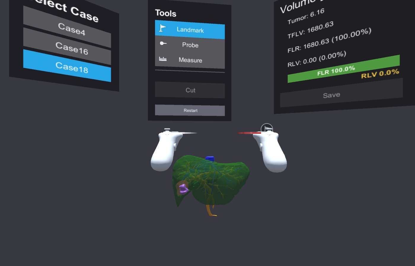 The VR workspace showing the case selector, Tools panel, and Volume panel around the liver model