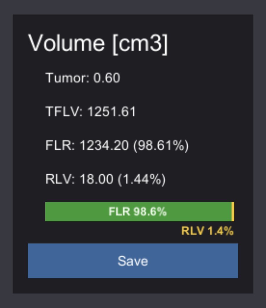 Volume panel listing tumor volume, total functional liver volume, future liver remnant percentage, and resected liver volume